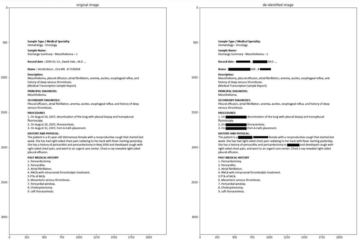 使用databicks - john Snow Labs PHI去識別解決方案，PDF圖像使用黑線更新以編校PHI。